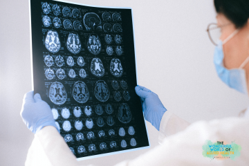 allied-health-newsletter-neuro-behavioral-changes
