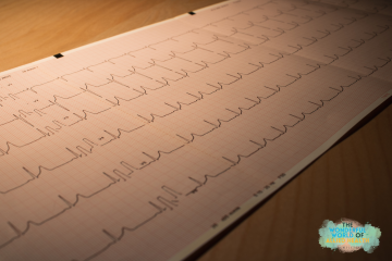 allied-health-newsletter-prehabilitation
