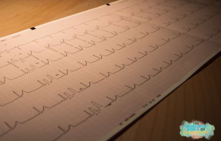 allied-health-newsletter-prehabilitation