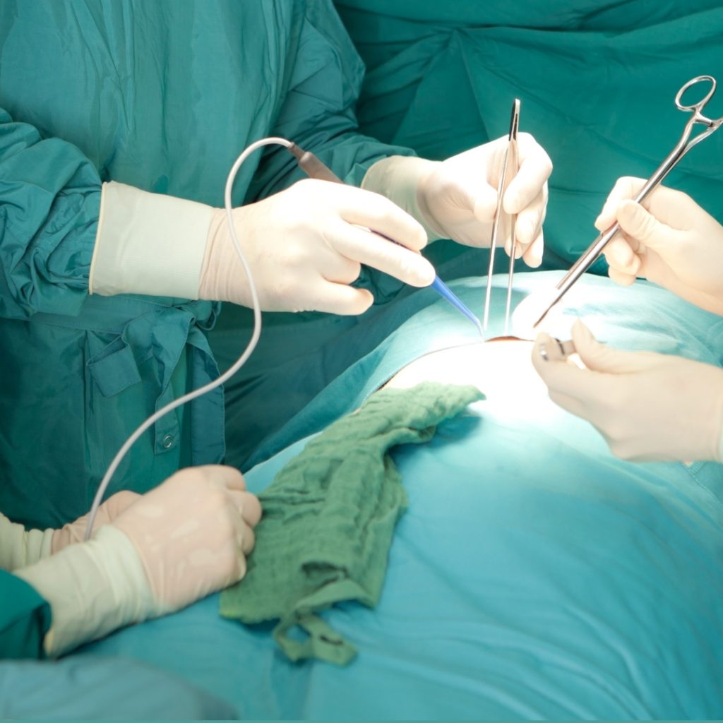 Why Your Doctor Told You About the Surgery — But Not About Prehab