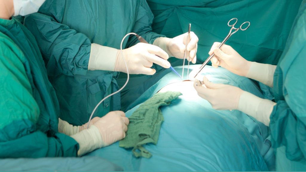 Why Your Doctor Told You About the Surgery — But Not About Prehab